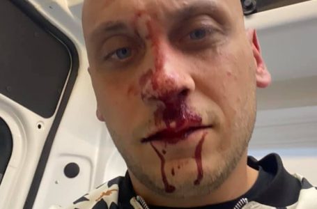 Един от контрапротестиращите е бил нападнат вчера пред дома си